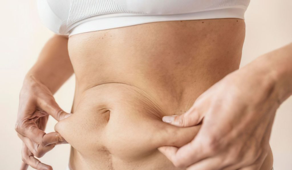 woman considering tummy tuck in richmond va