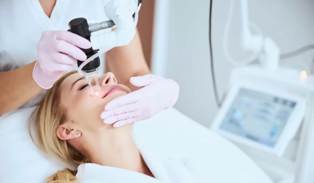 laser skin resurfacing in Richmond VA