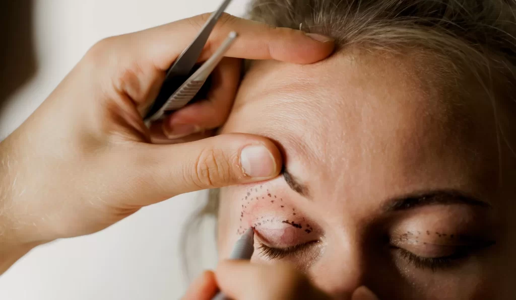 woman getting blepharoplasty in forest hills