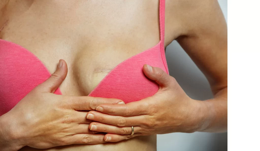 woman needing breast reconstruction revision surgeon